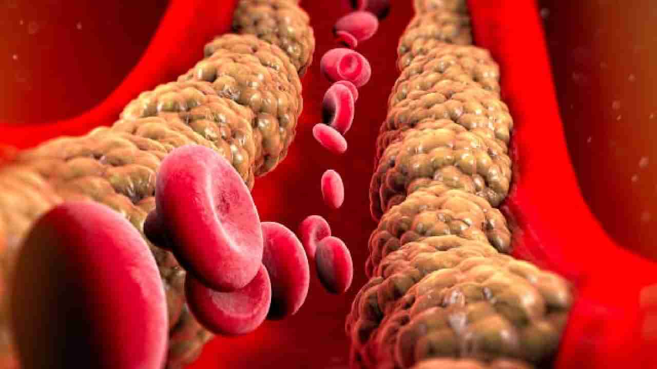 cholesterol : कोलेस्ट्रॉल कमी करण्यासाठी आहारात नक्की खा या 5 भाज्या