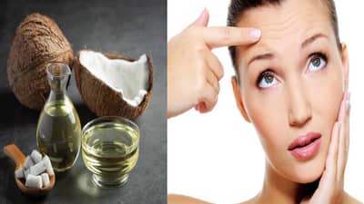 खोबरेल तेलात ही गोष्ट मिसळा अन् सुरकुत्यांना करा बाय-बाय, काय आहे तो पदार्थ ?