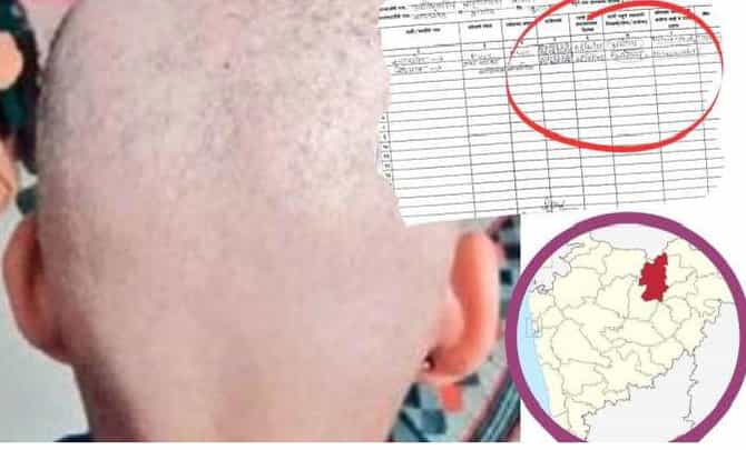 पाण्यामुळे नाही, फंगल इन्फेक्शन नाही...मग टक्कल पडतंय कसं? बुलढाण्यातील ग्रामस्थांना तपासण्यासाठी या राज्यांमधून डॉक्टर येणार