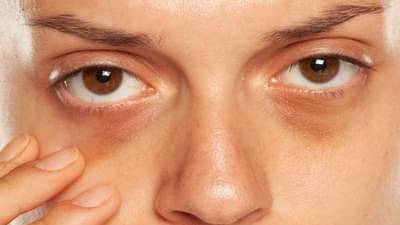 ऐका गंssss फक्त 10 रुपयात चेहऱ्यावरील काळे डाग हटवा, ट्रिक जाणून घ्या