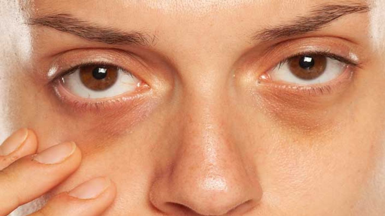 ऐका गंssss फक्त 10 रुपयात चेहऱ्यावरील काळे डाग हटवा, ट्रिक जाणून घ्या ऐका गंssss फक्त 10 रुपयात चेहऱ्यावरील काळे डाग हटवा, ट्रिक जाणून घ्या