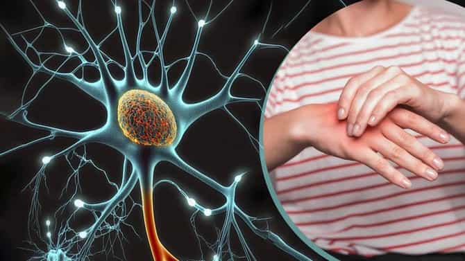 Guillain Barre Syndrome : मोठी बातमी! GBS चा पहिला बळी, पुण्यात तरूणाचा मृत्यू
