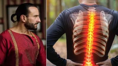 चाकू हल्ल्यात सैफ अली खान याच्या स्पायनल कॉडला जखम, अशा दुखापती का असतात धोकायदायक?