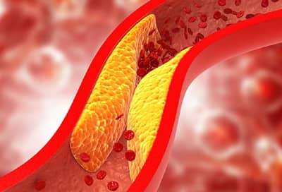 Bad Cholestrol Control: बॅड कॉलेस्ट्रॉल दूर करण्यासाठी सकाळी फॉलो करा या सोप्या ट्रिक्स...