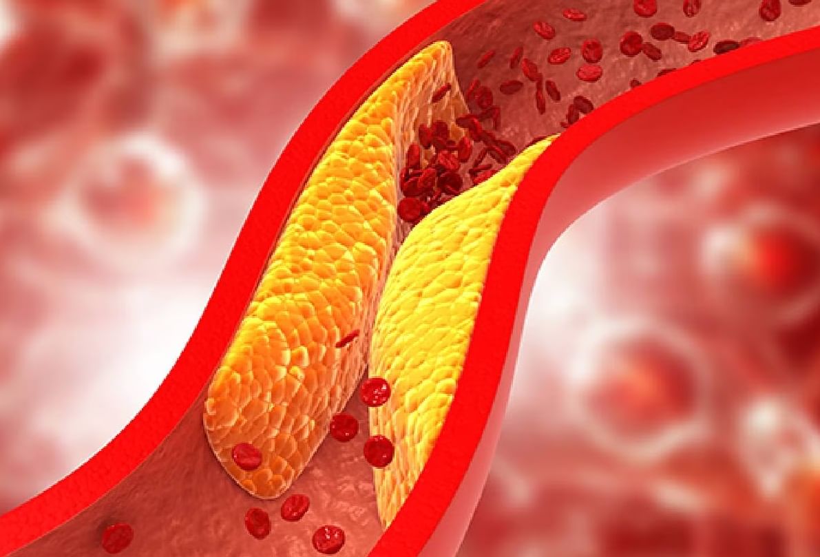 Bad Cholestrol Control: बॅड कॉलेस्ट्रॉल दूर करण्यासाठी सकाळी फॉलो करा 'या' सोप्या ट्रिक्स...