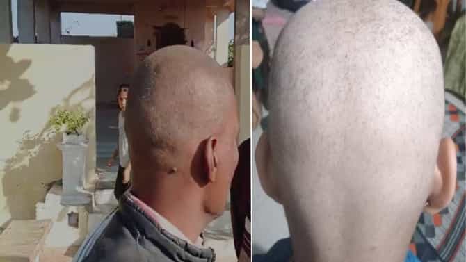 बुलढाण्यातील लोक अचानक टकले का झाले? अखेर झाला उलगडा; तुम्हीही ही चूक करत नाही ना?