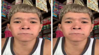 Viral Video: खोडसळपणा अंगलट..! ओठांवर ग्ल्यूच लावलं; त्यानंतर तरुणाचं जे झालं ते....