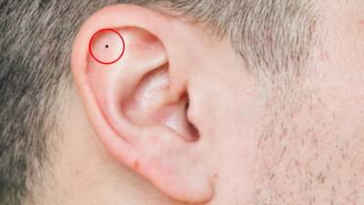 कानावरील तिळावरून समजतं तुमच्या आयुष्याचं रहस्य... ज्योतिषशास्त्र काय सांगतं?