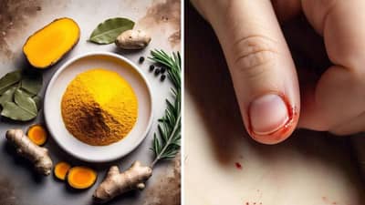 जखम झाल्यास हे उपाय थांबवतील रक्तस्त्राव, डॉक्टरांकडे जाण्याची देखील पडणार नाही गरज