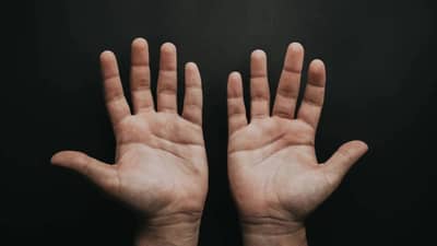 हिवाळ्यात तुमचीही बोटं सुजतात ? या उपायांनी हमखास मिळेल आराम