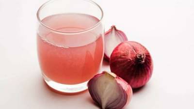Onion Juice Benefits: केसांवर हे तेल लावल्यास कोंड्याच्या समस्या होतील छुमंतर....