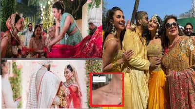 प्रियांका चोप्राच्या वहिनीला लग्नानंतर होतोय याचा त्रास,दाखवल्या मानेवरील खुना; म्हणाली हे काय चाललंय?