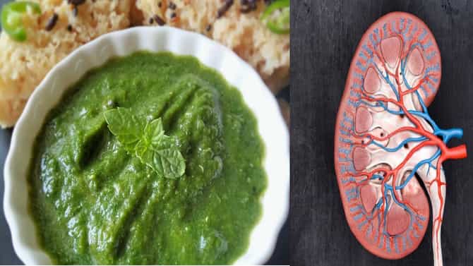 यूरिक अॅसिड, किडनीच्या समस्या दूर करण्यासाठी बनवा खास अन् टेस्टी चटणी
