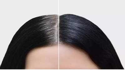 Natural Hair Care Tips: कमी वयामध्ये केस पांढरे का होतात? जाणून घ्या निरोगी केसांसाठी नेमकं काय करावे?