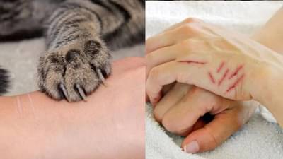 मांजरीच्या हल्ल्याकडे दुर्लक्ष करणं बेतलं जीवावर, तरुणाला गमवावा लागला जीव