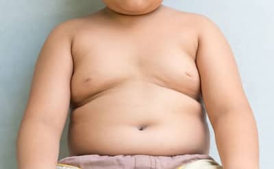 Obesity Control: लहान मुलांमध्ये लठ्ठपणाचा धोका वाढतोय? या ट्रिक्स करतील वजन कमी.....