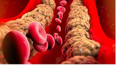Bad Cholestrol Control: खराब कोलेस्ट्रॉल दूर करण्यासाठी सकाळी उठल्यावर फॉलो करा या सोप्या ट्रिक्स...