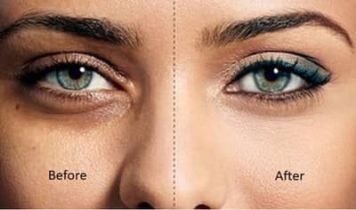 डार्क सर्कल कमी करण्यासाठी या 4 नैसर्गिक गोष्टींचा असा करा वापर