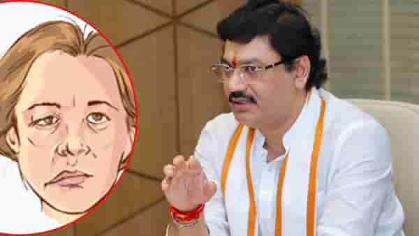 धनंजय मुंडेंना झालेला तो आजार नेमकं काय खाल्ल्याने होतो? लक्षणं काय? जाणून घ्या A टू Z माहिती