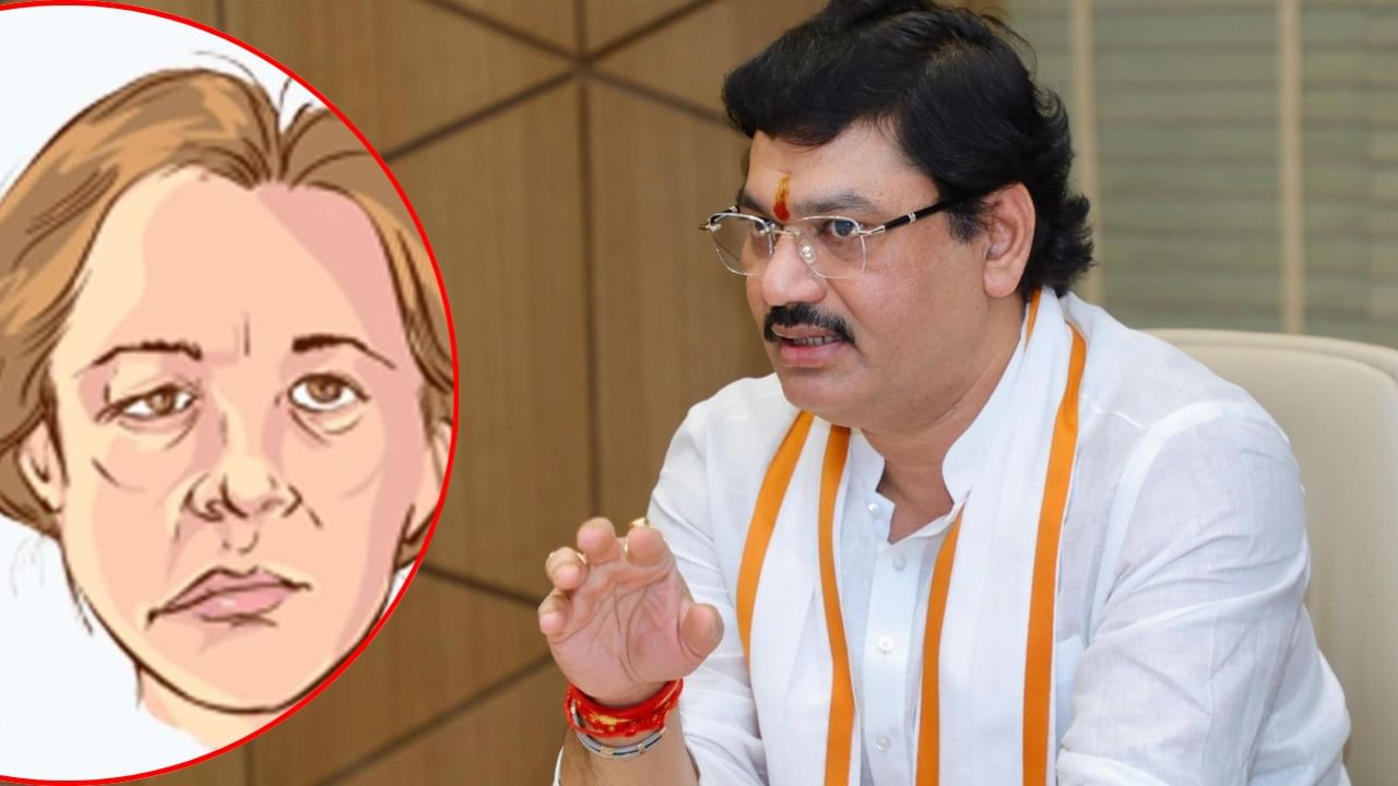 धनंजय मुंडेंना झालेला 'तो' आजार नेमकं काय खाल्ल्याने होतो? लक्षणं काय? जाणून घ्या A टू Z माहिती