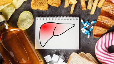 Fatty Liver: तुम्ही या पदार्थांचे तुमच्या दैनंदिन आहारात सेवन करत असाल तर सावधान!