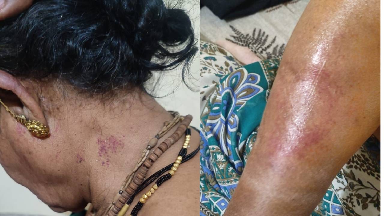 अजित पवारांच्या पदाधिकाऱ्याने जन्मदात्या आईलाचा केली मारहाण, महिलेने कथन केली आपबिती