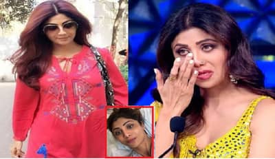 शिल्पा शेट्टीच्या डोक्यापासून मानेपर्यंत हजारो सुया टोचल्या; फोटो पाहून चाहते घाबरले