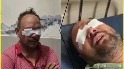 टकल्यावर एक केस सोडा, इथं डोळ्यांनाच झाली गंभीर इजा; रामबाण औषधाच्या नादात 65 बाला रुग्णालयात