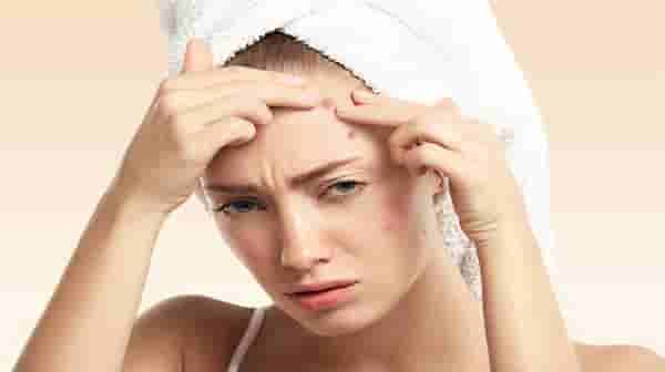 Skin Problems: चुकूनही चेहऱ्यावर या गोष्टी लावू नका पिग्मेंटेशन आणि पिंपल्सच्या समस्या होऊ शकतात....