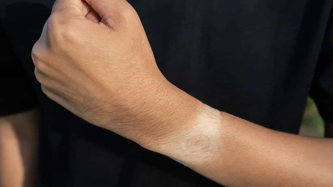 उन्हाळ्यात टॅनिंग होणार नाही, फक्त या गोष्टींची काळजी घ्या