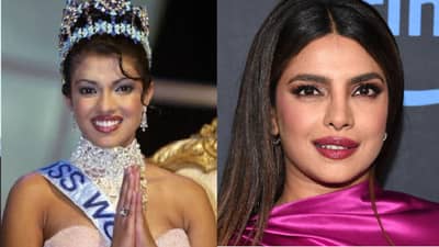 नाकाच्या शस्त्रक्रियेतील चुकीमुळे प्रियांका चोप्रा या गंभीर आजाराशी लढतेय; स्वत:च केला खुलासा