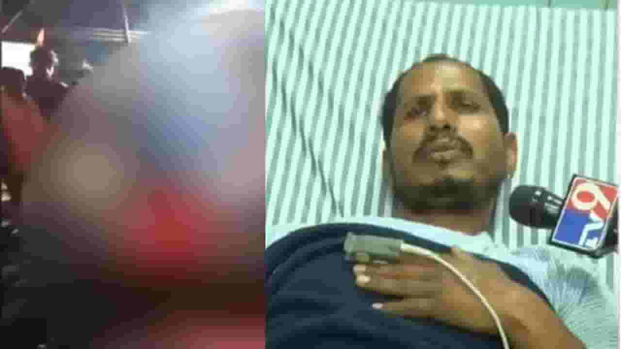 Jalna Kailash Borade Video : 'मला चटके देताना एवढंच म्हणायचे...', गरम सळईचे चटके दिलेल्या तरूणानं सांगितली धक्कादायक आपबीती Jalna Kailash Borade Video : 'मला चटके देताना एवढंच म्हणायचे...', गरम सळईचे चटके दिलेल्या तरूणानं सांगितली धक्कादायक आपबीती