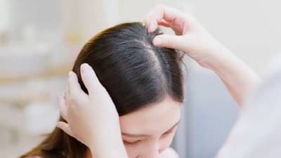 ऑईली हेअरची समस्या तुम्हाला खुप सतावत आहे? तर हे घरगुती उपाय एकदा अवलंबाच