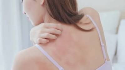 त्वचेची खाज ते उष्माघात; उन्हाळ्यातील आजारांपासून कशी मिळवाल सुटका?