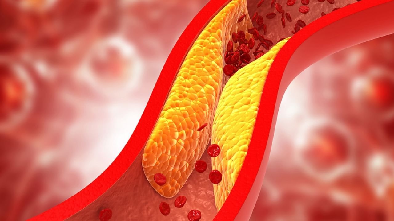 cholesterol