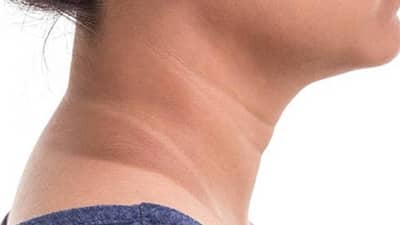 मानेवरचा काळेपणा नाहीसा होईल काही दिवसांत! जाणून घ्या हे सोपे घरगुती उपाय