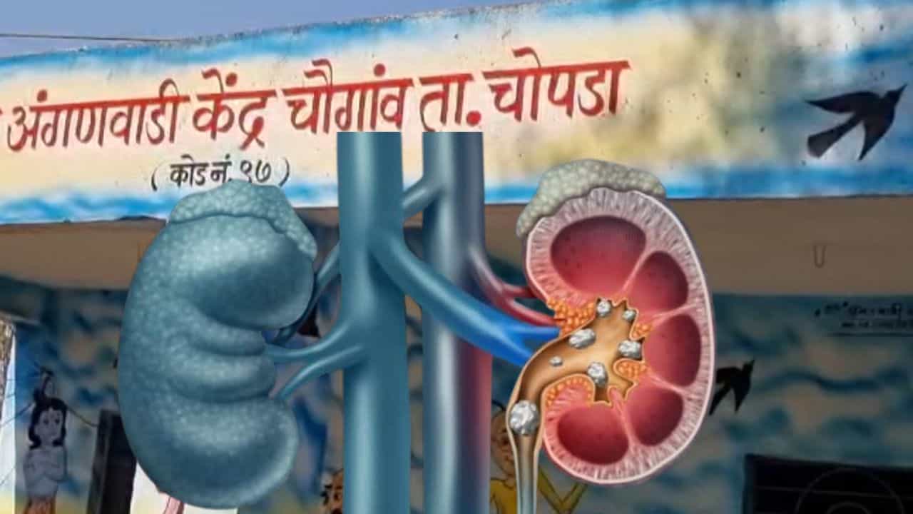 गावातील अनेकांना पिण्याच्या पाण्यामुळे जडले किडनींचे आजार, काही जणांची किडनी निकामी