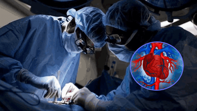 डॉक्टर असल्याचा बनाव, थेट लोकांचे हार्ट ऑपरेशन, 7 जणांचा मृत्यू; मुन्नाभाईचा थक्क करणारा कारनामा!