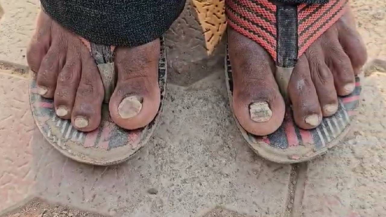 आरोग्य व जिल्हा प्रशासनाने आयसीएमआर रिपोर्ट दाबून ठेऊन रुग्णांना वाऱ्यावर सोडल्याचा नागरिकांचा आरोप आहे. 
