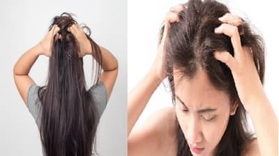 उन्हाळ्यात डोक्यामध्ये सतत खाज येत असेल तर या हिरव्या पानांचा करा वापर, लगेच आराम मिळेल