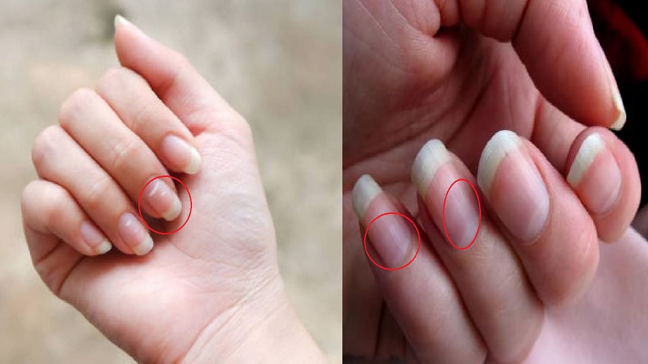नखांवर असणारे पांढरे डाग किंवा अर्धचंद्र शुभ किंवा अशुभ? काय फळ देतात?