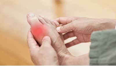 युरिक एसिड वाढलंय, या फूड्स पासून राहा दूर, अन्यथा त्रासात होणार वाढ