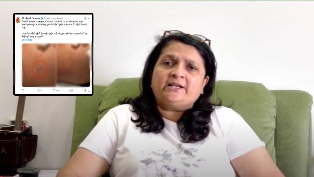 Vaishnavi Hagawane Case : हगवणे कुटुंब हे विकृत... वैष्णवीचा छळ केल्याचे फोटो दमानियांकडून ट्विट अन् केली मोठी मागणी