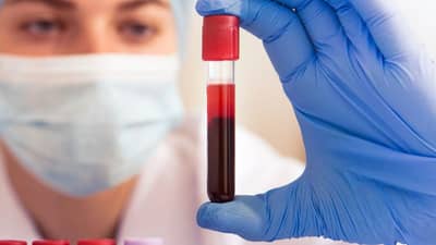 रक्त न काढता करा रक्त तपासणी, AI तंत्रज्ञानामुळे क्रांतिकारी बदल