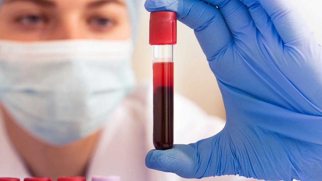 रक्त न काढता करा रक्त तपासणी, AI तंत्रज्ञानामुळे क्रांतिकारी बदल रक्त न काढता करा रक्त तपासणी, AI तंत्रज्ञानामुळे क्रांतिकारी बदल