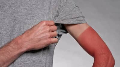 उन्हाळ्यात तुमचे हात टॅन झालेत, तर ते काढण्यासाठी हे घरगुती मास्कचा करा वापर