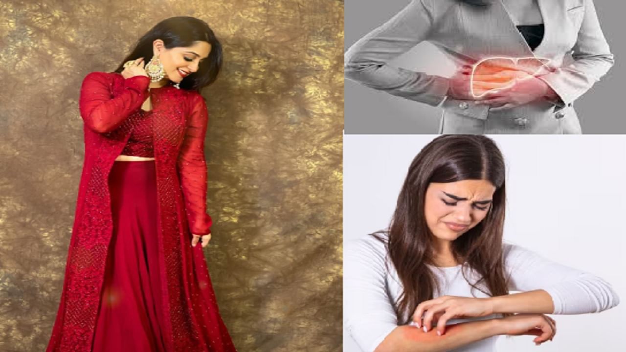 अभिनेत्री दीपिका कक्करला स्टेज-2 Liver Cancer; या सुरुवातीच्या लक्षणांकडे अजिबात दुर्लक्ष करू नका