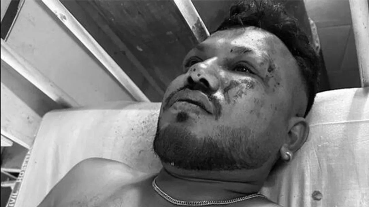 अहमदाबाद विमान अपघातात चमत्कार! एकमेव प्रवासी सुदैवाने वाचला, चालत आला बाहेर अन्...