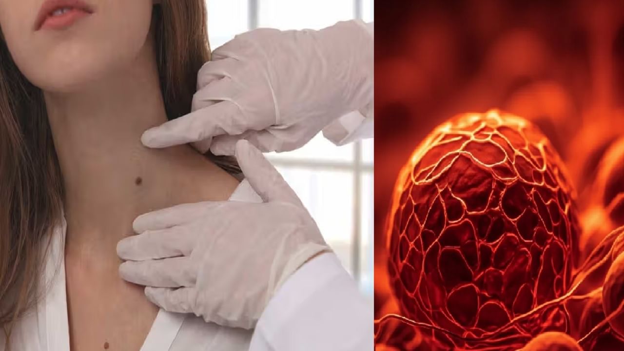 कॅन्सरच्या गाठीमध्ये वेदना होतात का? तज्ज्ञांनी सांगितली आहेत ही लक्षणे, तुम्हालाही आढळली तर सावधान!