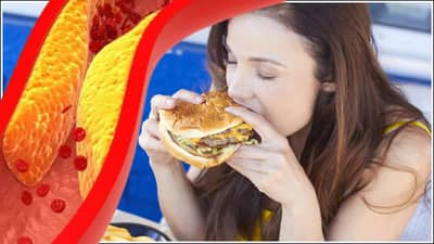 High Cholesterol: उच्च कोलेस्ट्रॉलमुळे हे गंभीर आजारही होऊ शकतात, जाणून घ्या लक्षणे